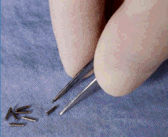 Photograph of a device used for low dose rate brachytherapy. 