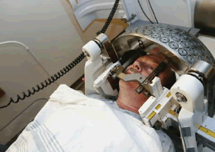 Gamma Knife in use